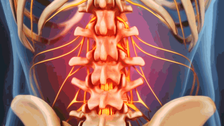 Gif of lower back pain.
