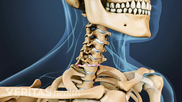 Medical illustration of the cervical spine