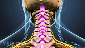 Medical illustration of the cervical spine.