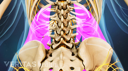 Posterior view of the muscles of the low back that can cause spasms.