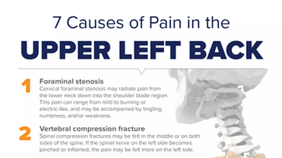 7 Causes of Pain in the Upper Left Back