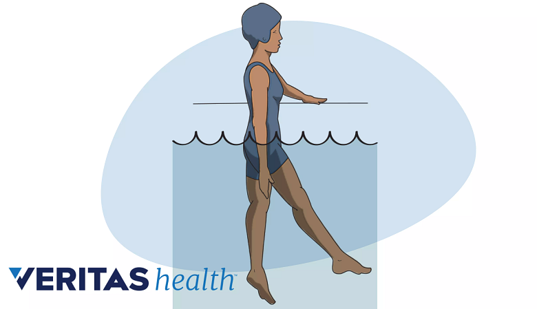 An illustration showing water therapy exercise.